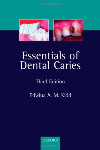 Essentials of Dental Caries: The Disease and Its Management (Kidd, Essentials of Dental Caries)