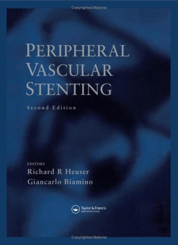 Peripheral Vascular Stenting: Second Edition