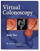 Virtual Colonoscopy