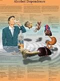 Alcohol Dependence Chart