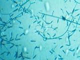 Helminthosporum Parasitic Infection Photographic Poster Print, 40x30