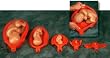 Uterus W/Fetus Model Set-HE27007