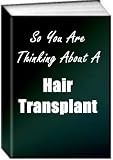 So You Are Thinking About A Hair Transplant