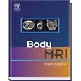 Body MRI by Evan Siegelman