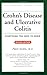 Crohn's Disease and Ulcerative Colitis: Everything You Need to Know (Your Personal Health)
