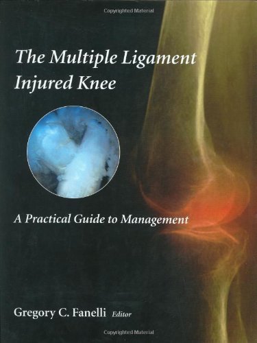 The Multiple Ligament Injured Knee: A Practical Guide to Management
