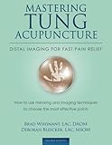 Mastering Tung Acupuncture - Distal Imaging for Fast Pain Relief: 2nd Edition