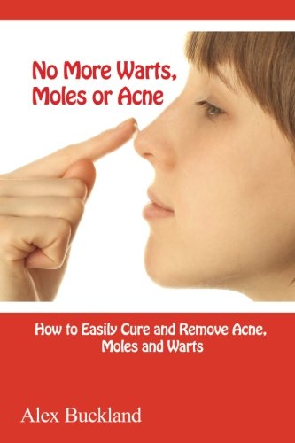 No More Warts, Moles or Acne: How to Cure and Remove Acne, Moles and Acn e