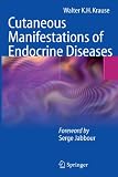 Cutaneous Manifestations of Endocrine Diseases
