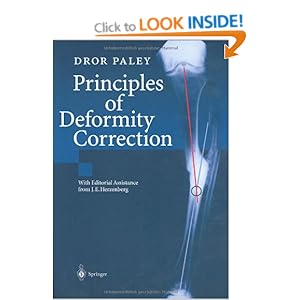 Paley Principles Of Deformity Correction Pdf Download Free Apps Paley Principles Of Deformity Correction Pdf Download Free Apps