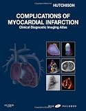Complications of Myocardial Infarction: Clinical Diagnostic Imaging Atlas with DVD (Cardiovascular Emergencies: Atlas and Multimedia)