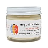Iwilla Remedy - My Skin Glows Nourishing Cream, 2oz. Calendula and Essential Oils Soothe and Hydrate Irritated Skin