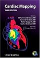 Cardiac Mapping