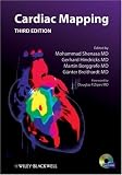 Cardiac Mapping