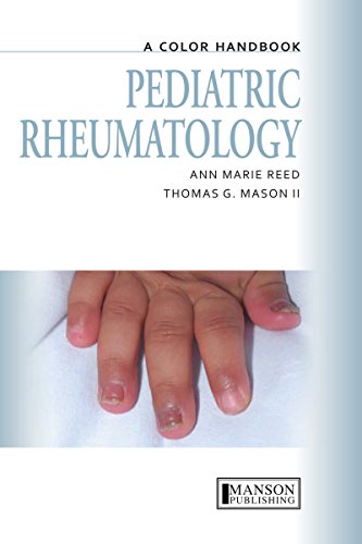 Pediatric Rheumatology: A Color Handbook (Medical Color Handbook Series)