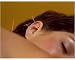 Photographic Print of Acupuncture from Science Photo Library