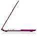Kuzy - Lace Rubberized Hard Case for Older MacBook Pro 15.4 inch with Retina Display A1398 15 inch Plastic Shell Cover - Lace Raspberry
