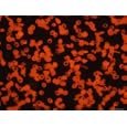 Photomicrograph Sickle Cell Disease Rbc Genes Photographic Poster Print, 32x24