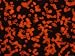 Photomicrograph Sickle Cell Disease Rbc Genes Photographic Poster Print, 16x12
