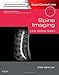 Spine Imaging: Case Review Series: Expert Consult - Online and Print