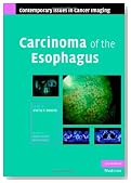 Carcinoma of the Esophagus (Contemporary Issues in Cancer Imaging)