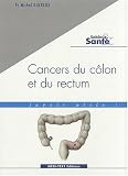 Cancers du c�lon et du rectum : savoir utile !