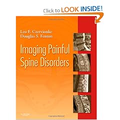 Click here to buy Imaging Painful Spine Disorders - Expert Consult by Leo F. Czervionke MD and Douglas S. Fenton MD.