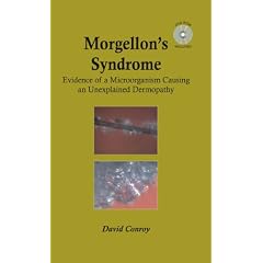 Morgellon's Syndrome by David Conroy