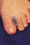 Silipos Gel Toe Spreader Large