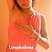 What You Should Know About Lymphedema: An easy to follow guide for patients, therapists and doctors alike for ninety nine cents. What You Should Know About Lymphedema: An easy to follow guide for patients, therapists and doctors alike for ninety nine cents.