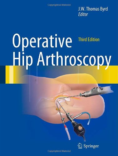 operative hip arthroscopy byrd operative hip arthroscopy