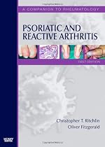 Psoriatic and Reactive Arthritis: A Companion to Rheumatology, 1e
