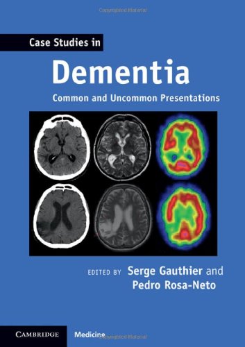 dementia diagnosis