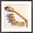 Artwork Showing Tissue and Cell Growth after Bone Grafting National Geographic Collection Framed Photographic Poster Print by Jane Hurd, 25x25