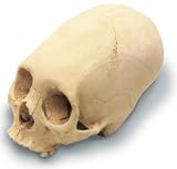 Annular Cranium W/Stand Antique Finish