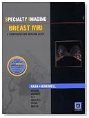 Specialty Imaging: Breast MRI: A Comprehensive Imaging Guide (Published by Amirsys&Acirc;&reg;)