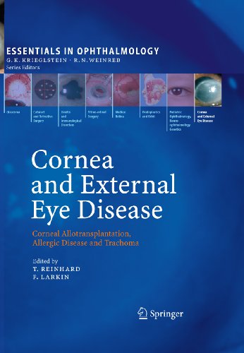 Cornea and External Eye Disease: Corneal Allotransplantation, Allergic Disease and Trachoma (Essentials in Ophthalmology)