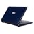 MSI Wind U123-001US 10.2-Inch Blue Netbook - 6 Cell Battery