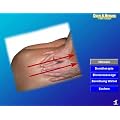 Dornmethode & Breussmassage (Software) inkl. Seminarskript