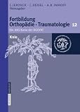 Fortbildung Orthop&auml;die im Set: Knie (Fortbildung Orthop&auml;die - Traumatologie)