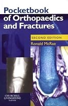 Pocketbook of Orthopaedics and Fractures (Churchill Pocketbooks)