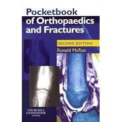 Pocketbook of Orthopaedics and Fractures (Churchill Pocketbooks)