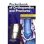 Pocketbook of Orthopaedics and Fractures (Churchill Pocketbooks)