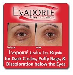 EVAPORT&Eacute; for Women - Dark Circles & Eye Bags Formula - Clinically Tested, Immediate and Long Term Benefits