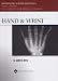  : Hand and Wrist (Orthopaedic Surgery Essentials Series)