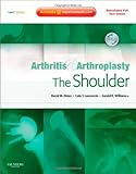 Arthritis and arthroplasty. The shoulder
