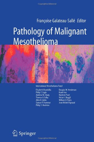 Pathology of Malignant Mesothelioma