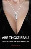 41uMf PozSL. SL160  Are Those Real?: True Tales of Plastic Surgery from Beverly Hills