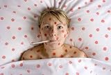 Woman with Red Spots on Face and Body 24W x 16H Peel and Stick Wall Decal by Wallmonkeys 41uNsvJFu0L. SL160 Woman with Red Spots on Face and Body 24W x 16H Peel and Stick Wall Decal by Wallmonkeys