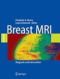 Breast MRI: Diagnosis and Intervention Breast MRI: Diagnosis and Intervention